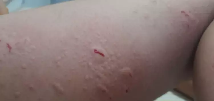 ...